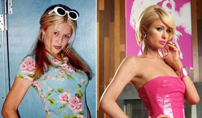 Worst celebrity plastic surgery fails