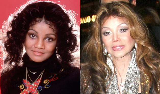 Worst celebrity plastic surgery fails