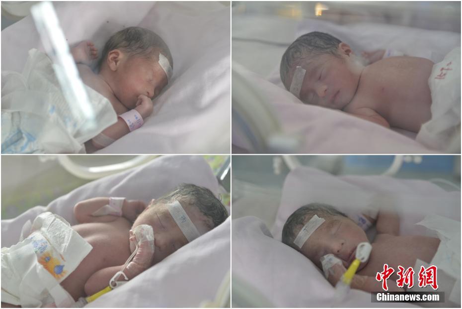 Extremely rare identical quadruplets born