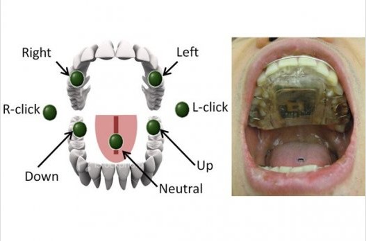 殘疾人可用舌頭操控輪椅！美研發(fā)易于操作驅(qū)動系統(tǒng)